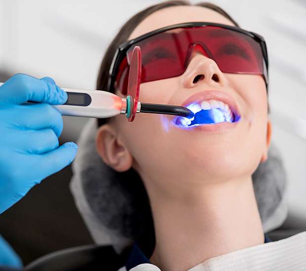 Denver Professional Teeth Whitening